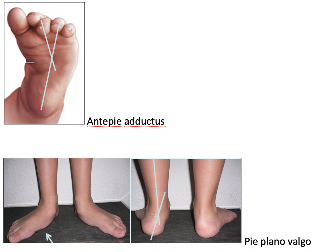 Figura 3. Valoración del pie.