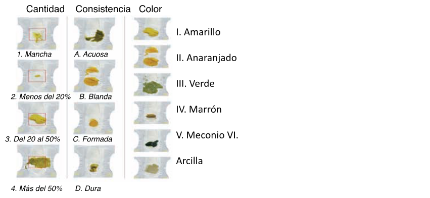 Escala de Ámsterdam